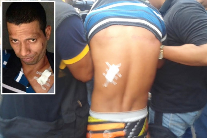 Edilson, 28 anos (detalhe) foi baleado durante troca de tiros com PM, na casa de câmbio