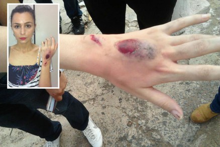 Estudante mostra sinais da agresso, que, segundo ela, foi praticada por militares