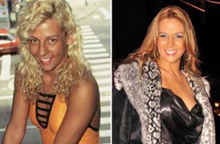 Carla Perez antes e depois da primeira plstica no nariz 