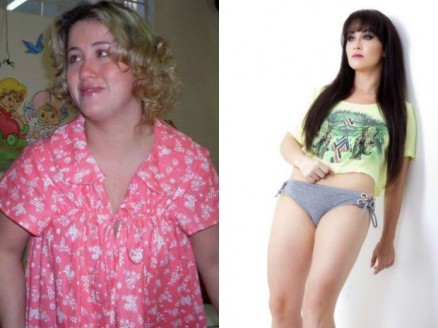 Antes e Depois. Leandra, de 35 anos, perdeu 30 quilos em um ano 
