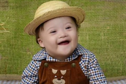 C�ssio tinha s�ndrome de down e passou por cirurgia no cora��o, mas n�o resistiu 