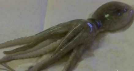 Polvo de 5cm foi encontrado na garganta de uma crian�a, na cidade de Wichita (EUA)  