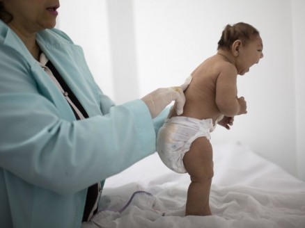 Aps analisar exames de bebs com microcefalia atendidos na AACD do Recife, pesquisadores pernambucanos identificaram possvel padro da doena associada ao vrus da zika