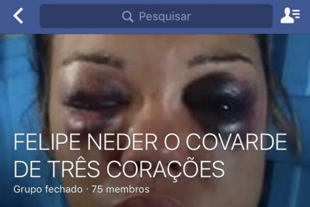 A vigilante agredida,  Edvnia Mayara, de 23 anos