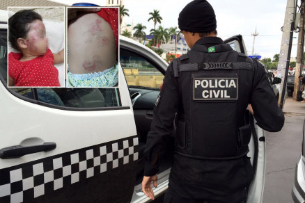 A Polcia Civil deve instaurar um inqurito para investigar as agresses