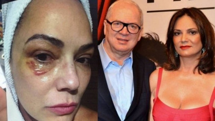 Luiza Brunet foi agredida pelo ento namorado Lrio Parisotto, em Nova York, em maio