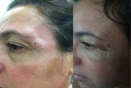 Vtima teve que pedir demisso depois de ser ameaada de morte