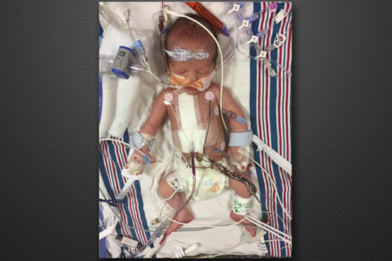 O filho recm-nascido do apresentador Jimmy Kimmel aps passar por uma cirurgia no corao
