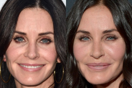 Courteney Cox em 2017, aps parar com procedimentos estticos, e em 2015