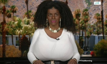 Martina Big faz aplicaes de bronzeamento artificial desde janeiro deste ano