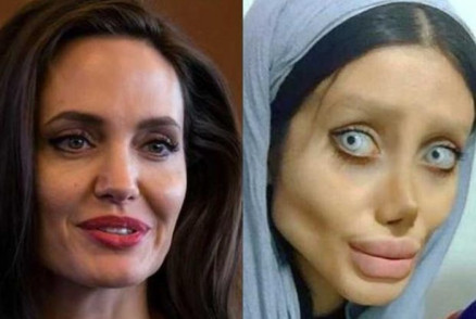 Sahar Tabar fez diversas plsticas para ficar parecida com Angelina Jolie
