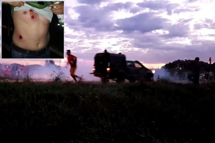 Manifestante ferido por bala de borracha (detalhe) em confronto com Exrcito