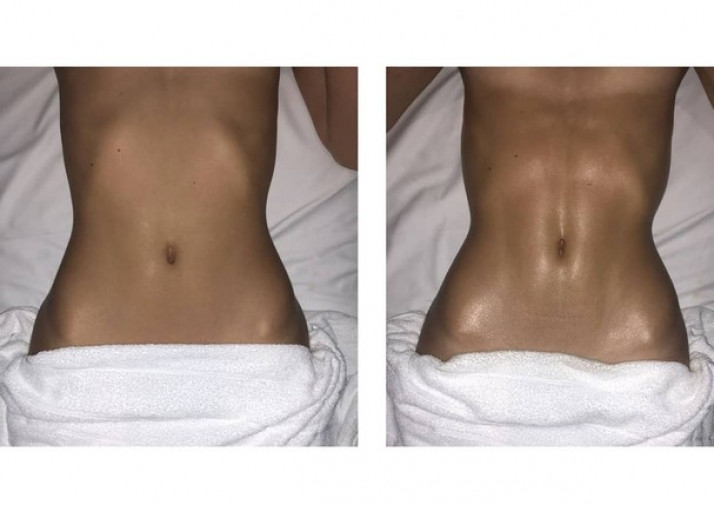 marquezine