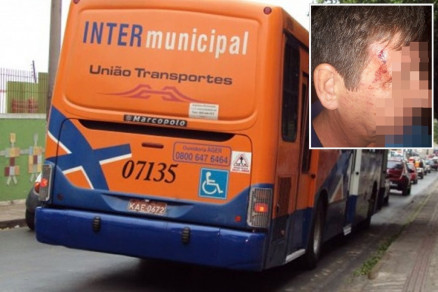 Com a agresso, motorista (detalhe) da Unio Transporte teve corte no olho