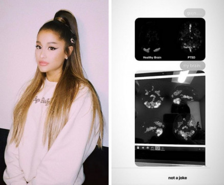 As tomografias compartilhadas pela cantora Ariana Grande 