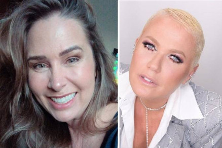 Andra Sorveto e Xuxa: procedimento esttico foi motivo de polmica 
