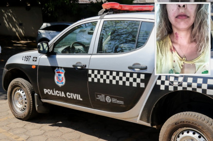 Mulher relata que foi enforcada pelo ento namorado por quatro vezes (detalhe)