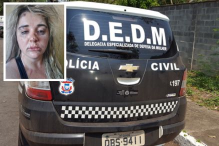 A secretria de Administrao de Aripuan Claudia Tsch (detalhe) aparece com cortes e hematomas no rosto