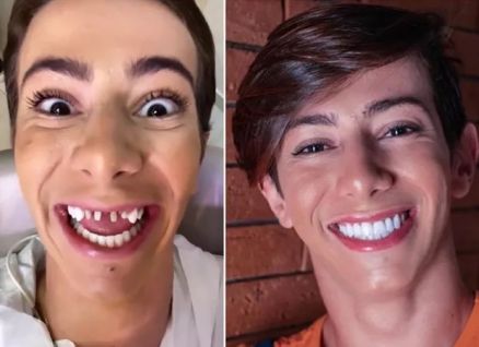 Davi Mateus mostrou sorriso antes do procedimento odontolgico 