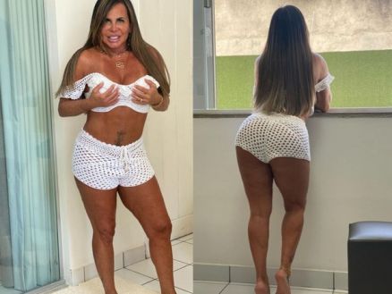 Gretchen no esconde dos fs os seus procedimentos estticos