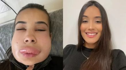 �sis disse que come�ou a sentir ard�ncia assim que procedimento foi iniciado em Palmas