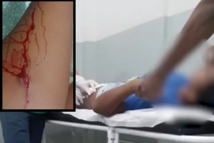 Durante a briga, uma das estudantes cortou a outra com um canivete 