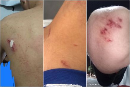 Vtima ficou ferida em vrias partes do corpo aps agresses 