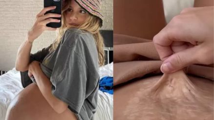 A atriz Isa Scherer grvida de gmeos ( esquerda) mostra sua barriga no ps-parto ( direita)