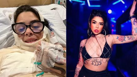 Juliana Maddeira teve 10% do seu corpo queimado aps exploso com uma panela de fondue
