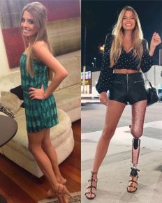 Paola Antonini estreou o Logo Ali (Globo Minas) em novembro de 2023� - Veja mais em https://www.uol.com.br/splash/noticias/2023/12/27/apresentadora-da-globo-lembra-grave-acidente-no-qual-perdeu-perna-ha-9-anos.htm?cmpid=copiaecola