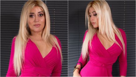Mulher Abacaxi planeja nova plstica aos 52 anos