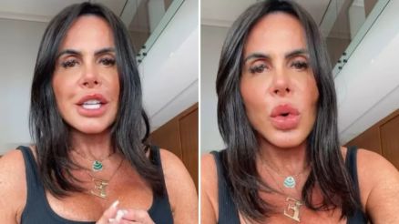 Gretchen mostra novo rosto aps procedimento