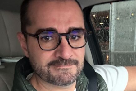 Marcelo Cosme mostrou resultado de transplante capilar