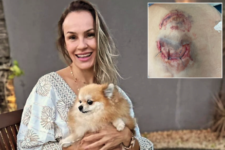 Andreia sofreu uma mordida na regio dos glteos durante mergulho com tubares