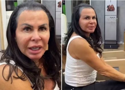 A cantora aparece com o cabelo ralo, quase sem fios