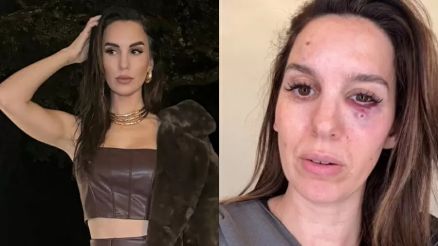 Ex-estrela da Disney levou tiros no rosto e foi hospitalizada