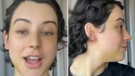 Z Longuinho exibe resultados de feminizao facial