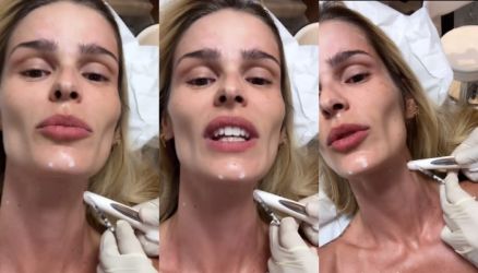 A modelo Yasmin Brunet, de 36 anos