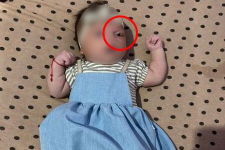 A beb� Analis, de 1 m�s e 11 dias, que precisa de cirurgia (foto divulgada pela fam�lia)