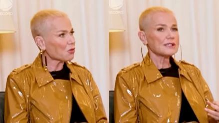 Xuxa Meneghel explica motivo de fazer transplante capilar