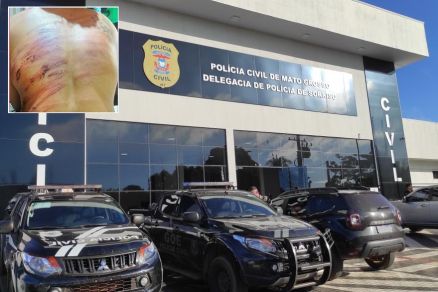 Mulher foi at delegacia de polcia de Sorriso aps ser brutalmente agredida (em detalhe)