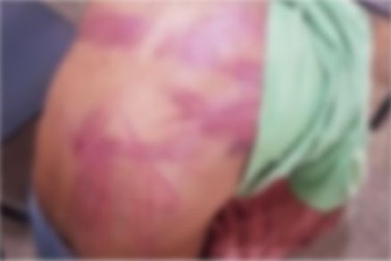 O homem foi torturado pelos criminosos e precisou de atendimento hospitalar 