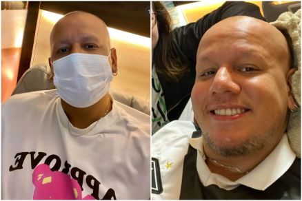 Ivann Milhomem, 28 anos, durante sesso de imunoterapia: tratamento foi suspenso por ineficcia