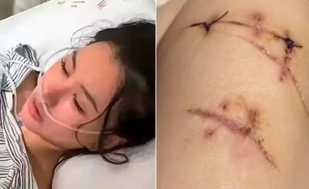 Chinesa golpeada com faca 22 vezes foi salva por prteses de silicone