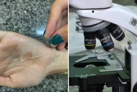 Lmina com o sangue retirado com a mesma agulha ante uma testagem sangunea em aula de Qumica, em Laranja da Terra 