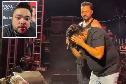 Vocalista da banda Rick Rocha apresentou sangramento aps ser atingido 