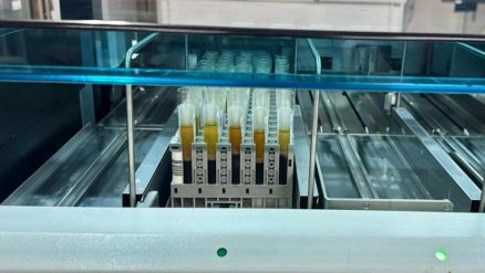 Os exames do MT Hemocentro permitem identificar doenas infecciosas que poderiam ser transmitidas ao receptor, minimizando riscos