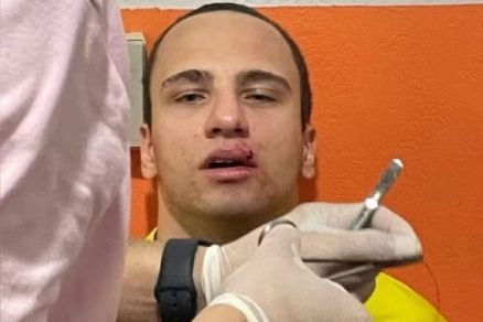 O rbitro assistente, Gustavo Anibel Taques, que precisou de sutura na boca aps ser agredido