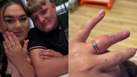 Iona Hadaway, de 23 anos, ficou sem circulao no anelar horas depois de dizer 'sim' 