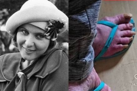 A atriz Rejane Schumann na dcada de 1970 e quando foi resgatada em situao de abandono, no incio de setembro